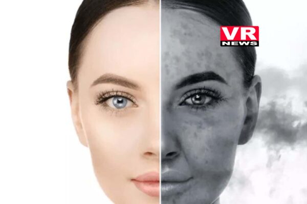 Pollution Effects On Skin: बढ़ता प्रदूषण आपकी त्वचा को भी पहुंचा रहा है नुकसान