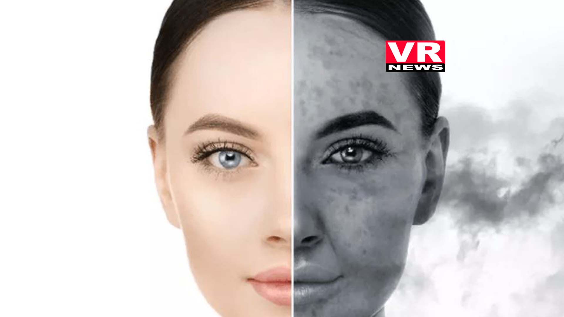 Pollution Effects On Skin: बढ़ता प्रदूषण आपकी त्वचा को भी पहुंचा रहा है नुकसान
